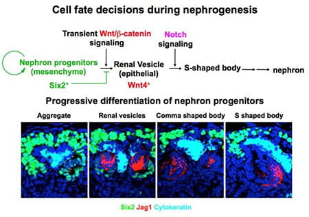Nephron progenitors express Six2, a transcription factor that is required for progenitor self-renewal. Differentiation of nephron progenitors is induced by Wnt/b-catenin and Notch signals. We have shown that Six2 represses differentiation of nephron progenitors by preventing Wnt/b-catenin signaling from activating key differentiation genes, such as Fgf8 and Wnt4. Once expression of Six2 is downregulated, nephron progenitors undergo differentiation by responding to Wnt/b-catenin and Notch signals.